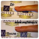 База каучуковая Nogtika Gel Polish Base Lux, 5 мл